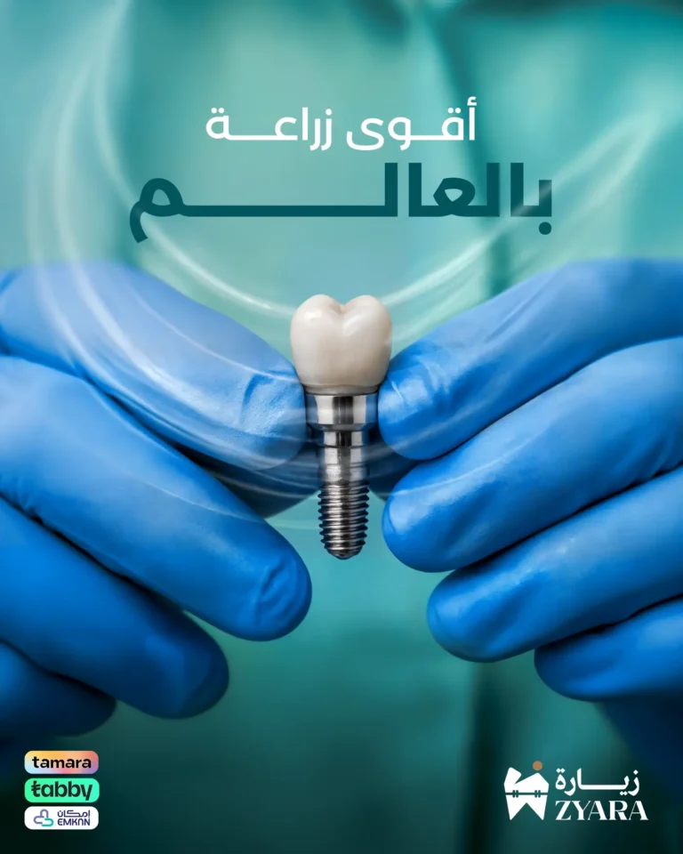 طبيب يحمل أحدث وأقوى زراعة أسنان في العالم لتعويض الأسنان المفقودة بشكل دائم في مجمع زيارة، أفضل عيادة أسنان في خميس مشيط.