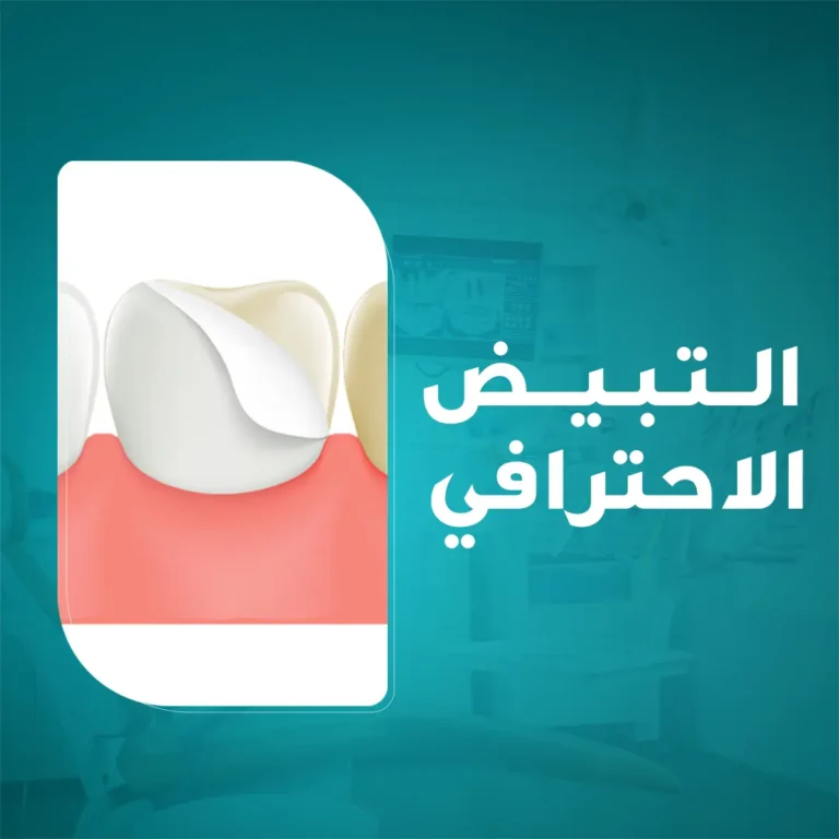 الحصول على ابتسامة ناصعة البياض وجذابة مع خدمة التبييض الاحترافي للأسنان في مجمع زيارة، أفضل عيادة أسنان في خميس مشيط.