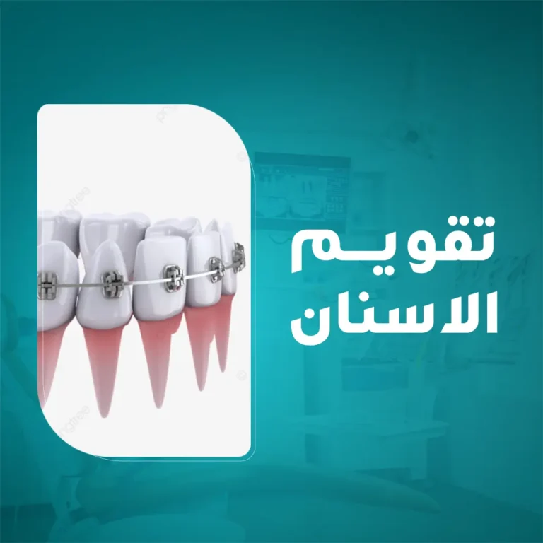 تركيب تقويم الأسنان لعلاج تزاحم وبروز الأسنان والحصول على ابتسامة مثالية في مجمع زيارة، أفضل عيادة أسنان في خميس مشيط.