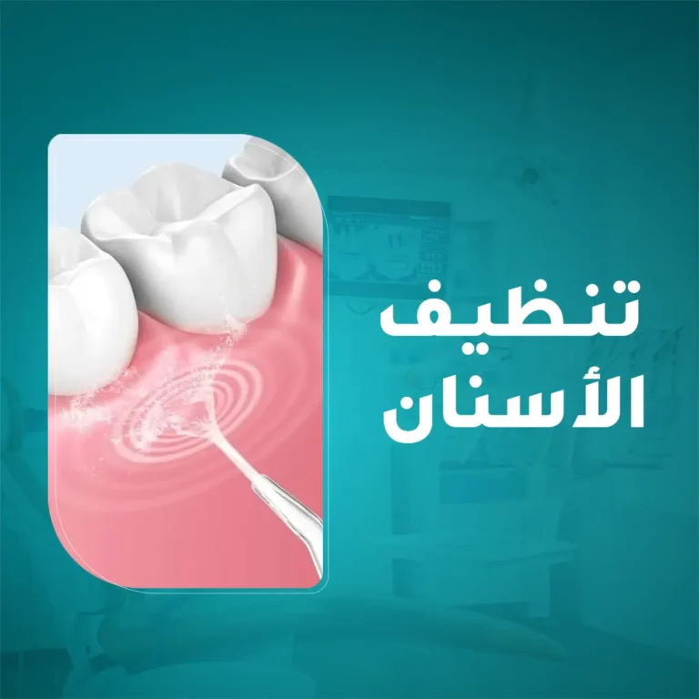 العناية بصحة اللثة وإزالة الجير والتصبغات من خلال جلسات تنظيف الأسنان الاحترافية في مجمع زيارة، أفضل عيادة أسنان في خميس مشيط.